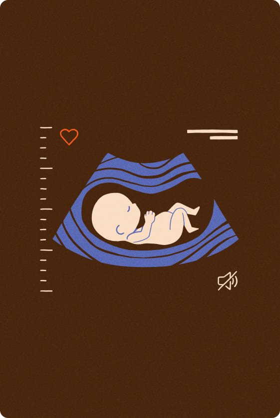 Illustrated graphic of a fetus in an ultrasound, set against a brown background